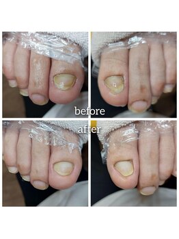 爪切り屋 足楽/