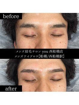 ユー 西船橋店(you)/ビフォーアフター写真