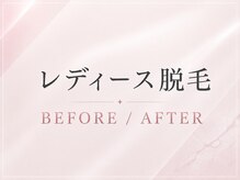 エルミューノ(elμno)/ここからレディース症例です