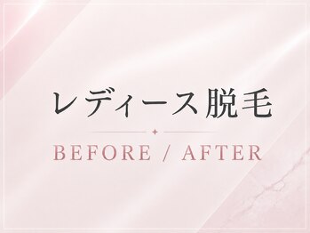 エルミューノ(elμno)/ここからレディース症例です