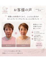 小顔美肌ファクトリー 梅田院/お客様の声