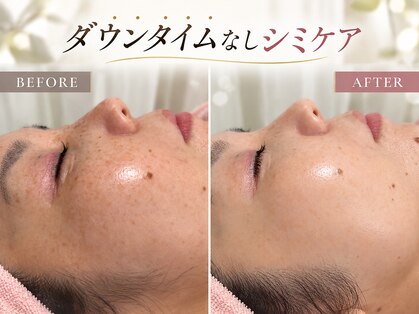 サロンドエテ(salon de ete)の写真
