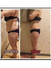 アンリール 旭川店(Anrire)/BODY施術のお客様です！