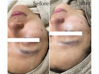 モンクラッシー(Mon classy)/