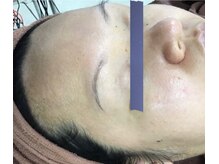 エスティフル 狭山店(ESTIFUL)/Before/フェイシャル/マッサージ