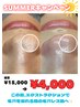 サマーキャンペーン★毛穴大掃除！エクストラクション60分　¥15,000→¥4,000