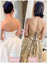 ポノ インディバ サロン(pono. Indiba salon)/痩身・ブライダル・ニキビ改善