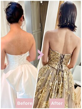 ポノ インディバ サロン(pono. Indiba salon)/痩身・ブライダル・ニキビ改善