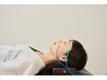 ハリナチュレ 新宿店/フェイスアップ美容鍼