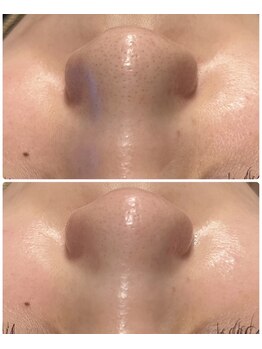 プルティティア 池下 今池 覚王山(Pultitia)/