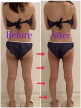 スペチアーレ 夙川/浮腫みの無い脚長に★