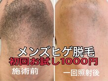 なちゅらる 苫小牧の雰囲気（MENSヒゲ脱毛初回お試し1000円安心の都度払い！ヒゲ剃り要らず）