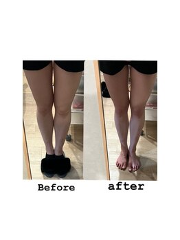 エクラ(ECLAT)/セルゼロ痩身コース