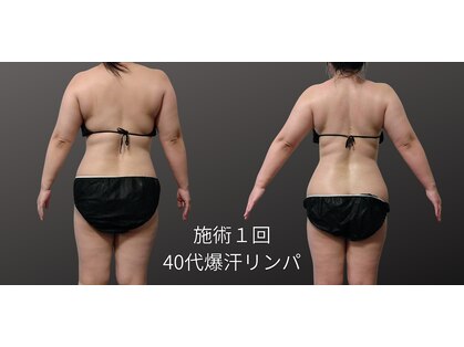 フロレゾン(Floraison)の写真