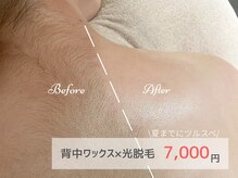 ピミル(PIMIL)