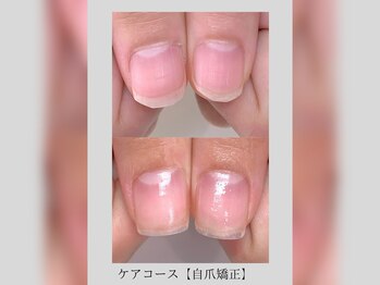 オベリオアトリエ(OBERIO ATELIER)/【自爪育成】凛 -rin- | care