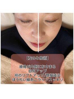 ココオーブ(COCO AUBE)/本格ドライヘッドスパで小顔に