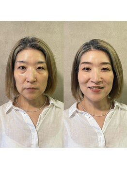 パーソナルサンフラワー(PersonalSunflower)/お客様ヘアメイクBefore/After