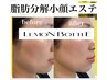 最新小顔美容！【レモンボトル＋ラジオ波】脂肪分解フェイシャル