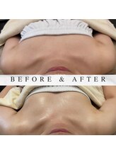 ヘブンビューティー(Heaven Beauty)/