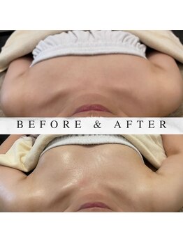 ヘブンビューティー(Heaven Beauty)/