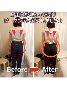 ラヴィフルリル(Ravi FleuRir)/美容整体の一回の変化