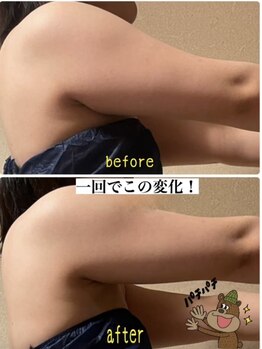 ヨサパーク ハット(YOSA PARK HAT)/気になる二の腕も☆