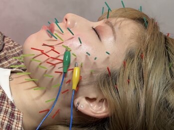 オアシストウキョウ 表参道(OASIS TOKYO)/サボテン美容鍼+小顔パルサー