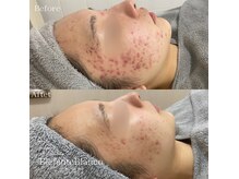 エレファンテブランコ(Elefante Blanco)の雰囲気（肌質を見極めてメニューをご提案！症例写真はフォトへ）