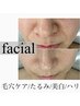 【Facial】幹細胞フェイシャル＋炭酸ヘッドマッサージ  ハリ艶/ニキビケア