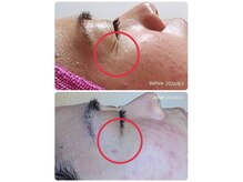 フェアリー(Fairy)の雰囲気（秋枯れ肌レスキュー！猛暑で奪われた水分を補充してウルツヤ肌へ）