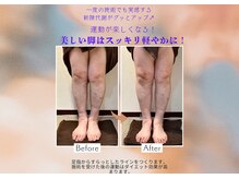 サロン ド ビューティー ラ デュース/足裏マッサージ
