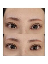 バニーアイズ 天神(Bunny eyes TENJIN)/トリートメントラッシュリフト