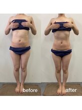 リラクラージュ(Ri Ra Courage)/40代１回施術後