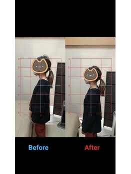 アリアーレ(ALIARE)/姿勢改善　１