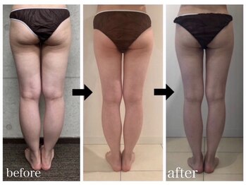 美人バスト 渋谷店/【痩身・ダイエット】 渋谷/脚☆