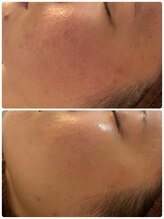 ル シェリア(Le Cherien)/アンストレス♪