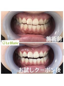 ルブラン 奈良店(Le Blanc)/お試しクーポンから♪