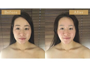 グレースフィオーレ 那覇店(gracefiore)/☆ビフォーアフター１１☆