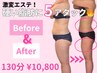 【全身痩身】人気No.1◎結果の速さモンスター級!6種痩身マシン130分 ¥10800