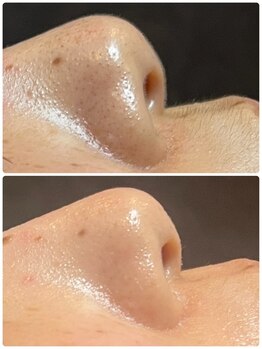 ソルエユニーク(Le seul et unique)/ワックス×毛穴洗浄★