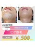 メンズ/ヒゲ1部位　50分　￥500