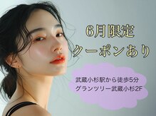 ダイヤモンドアイズ グランツリー武蔵小杉店(DIAMOND EYES)