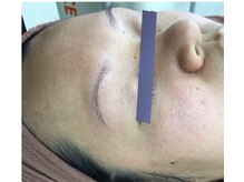 エスティフル 狭山店(ESTIFUL)/After/フェイシャル/マッサージ