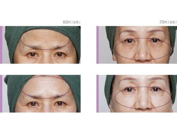 フルールドリス(FLEUR DE LIS)/毛穴洗浄でごっそりツルピカ肌に