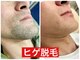 アン(an.)の写真/メンズ脱毛もお任せ！気になる箇所をお好きな部位で施術可能！お肌のお悩みはプロにお任せを♪