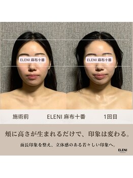 エレーニ 麻布十番(ELENI)/立体感のある若々しい印象へ