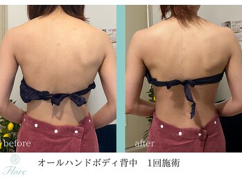 フローレ 平針店(Flore)/ブライダルにもおすすめ♪