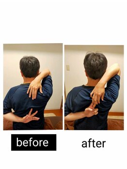 アース エンジェル整体院/ビフォアフ 肩甲骨ストレッチ