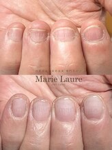 マリーロール 梅田店(Marie Laure)/自爪育成/深爪矯正/ネイルケア